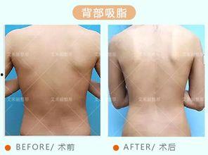 成人背部腰部矫正视频,告别疼痛，重拾健康生活