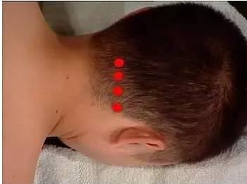 成人头部推拿教程视频,轻松掌握成人头部按摩技巧